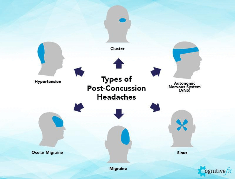 Post-Traumatic Headaches: Causes and Treatment Options