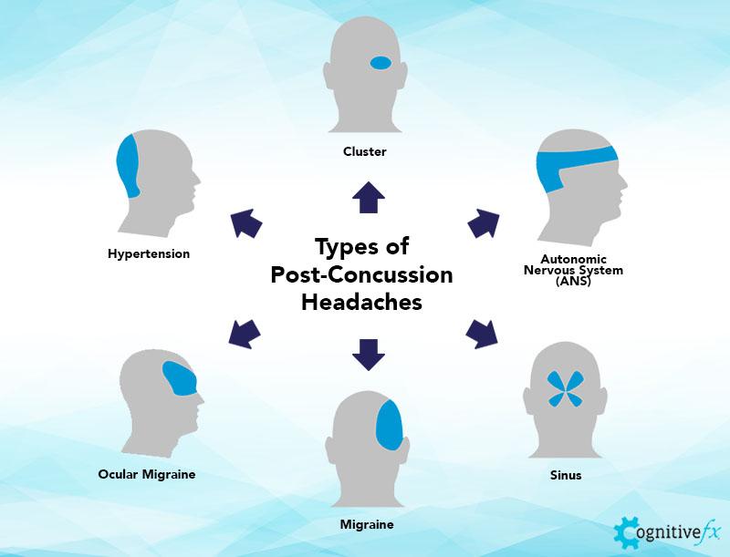 Concussion Headaches Or Post Traumatic Headaches Cognitive FX   Concussion Headaches And Post Concussion Headaches 2 