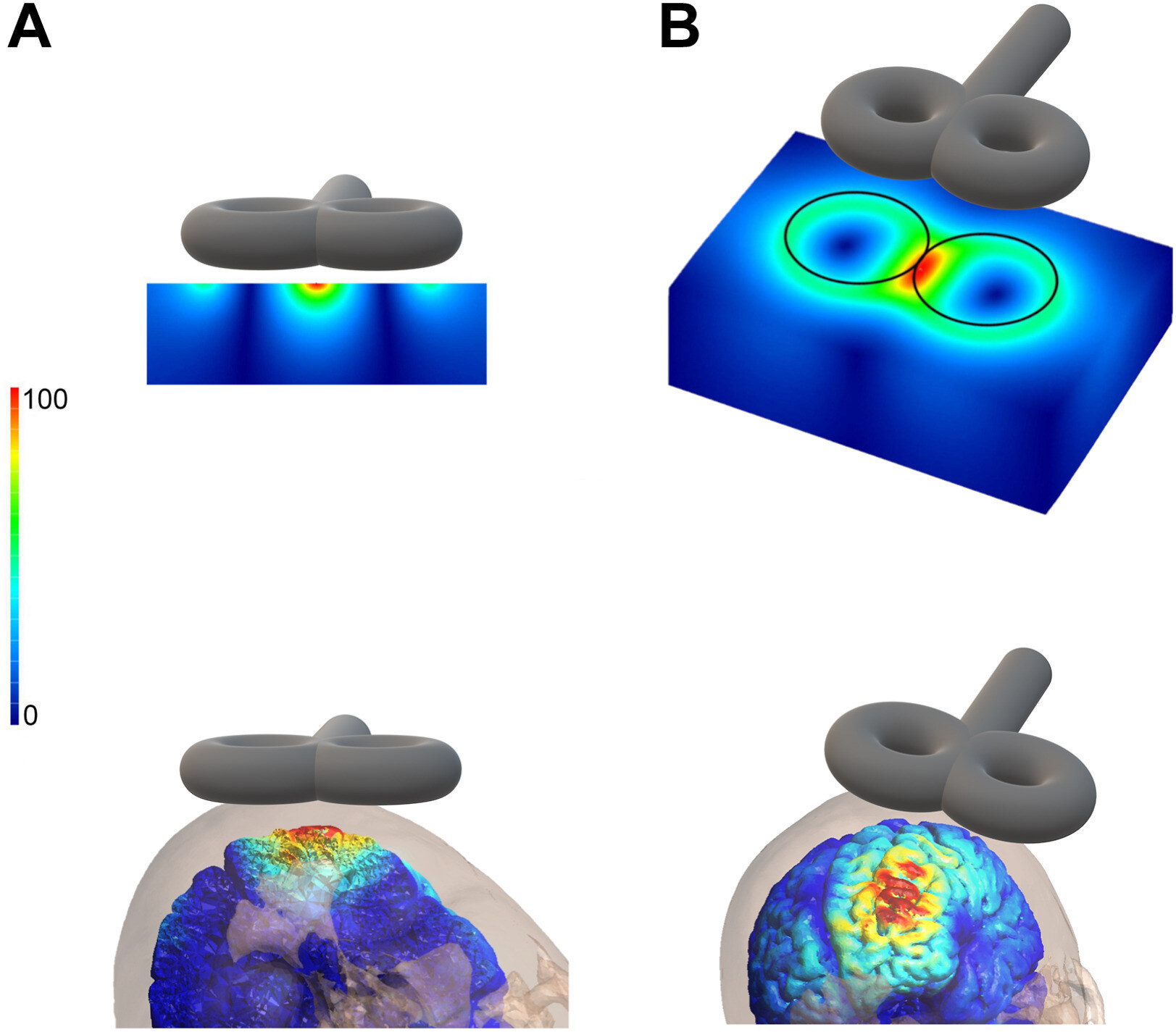 efield Transcranial Magnetic Stimulation Chen et al 2024