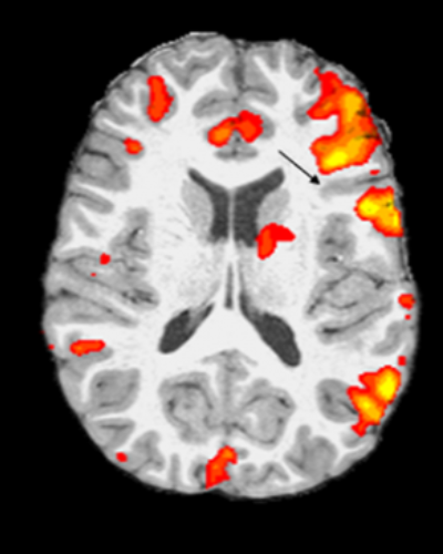 fMRI Example