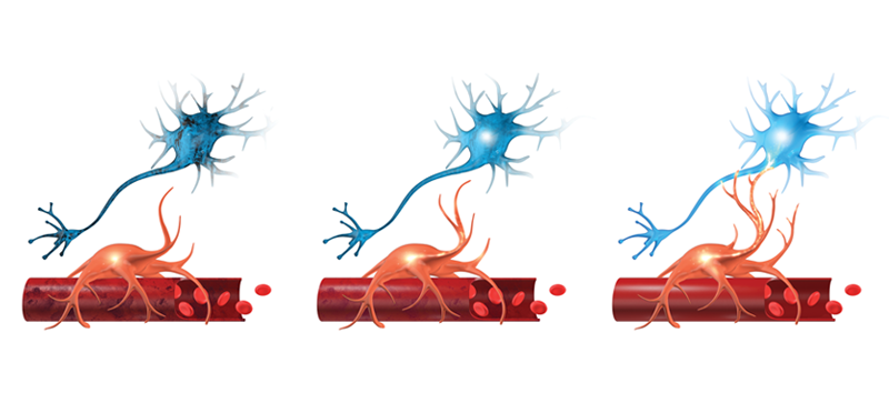 what happens with the neurons in your brain during a concussion